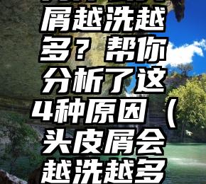 为什么头屑越洗越多？帮你分析了这4种原因（头皮屑会越洗越多吗）